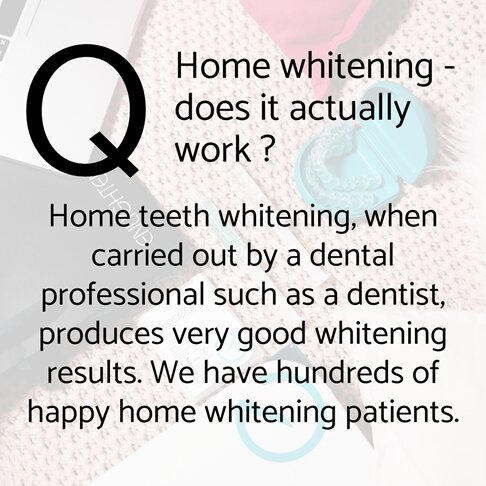 Home teeth whitening - frequently asked questions - does home teeth whitening actually work