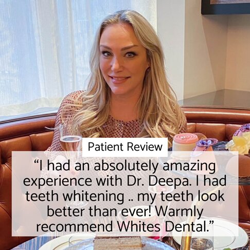 Home whitening London - patient testimonial for home whitening with Dr Deepa