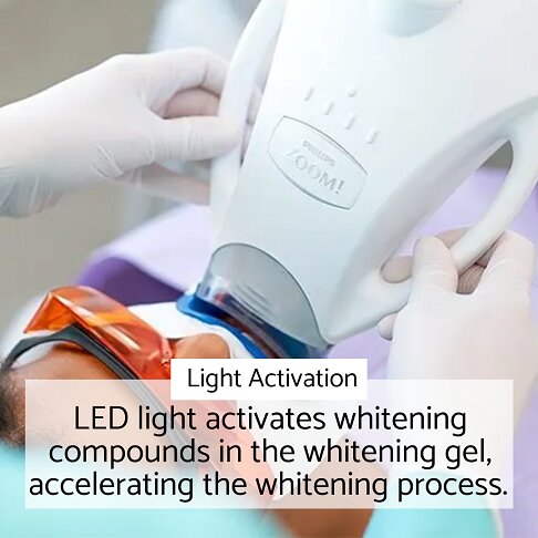 photo of the London in-clinic laser light teeth whitening Zoom whitening light activation procedure