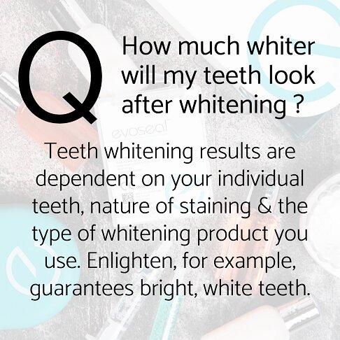 Teeth whitening Cost - frequently asked questions - How much whiter will my teeth look after whitening