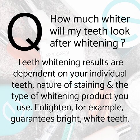 Teeth whitening London frequently asked questions - How much whiter will my teeth look after whitening