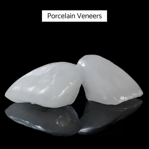 Dental Veneers London - Porcelain Veneers