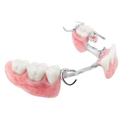 Chrome metal dentures in London