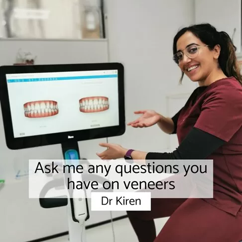 Porcelain Veneers - Ask Dr Kiren any questions you may have