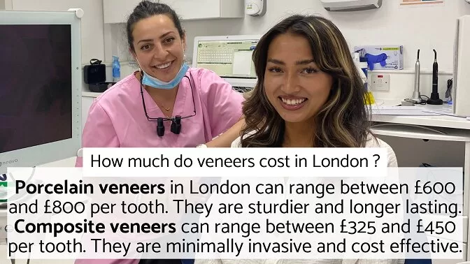 Veneers Cost London - How Much Do Veneers Cost In London