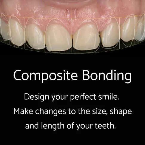 Cosmetic Dentist London - What Is Composite Bonding