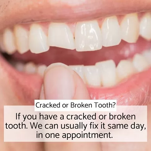 Cracked tooth illustration with text about same-day repairs from Emergency Dentist Marble Arch W2