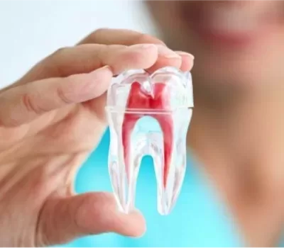 Hand holding tooth model with roots, representing Emergency Dentist Paddington’s specialized treatment options