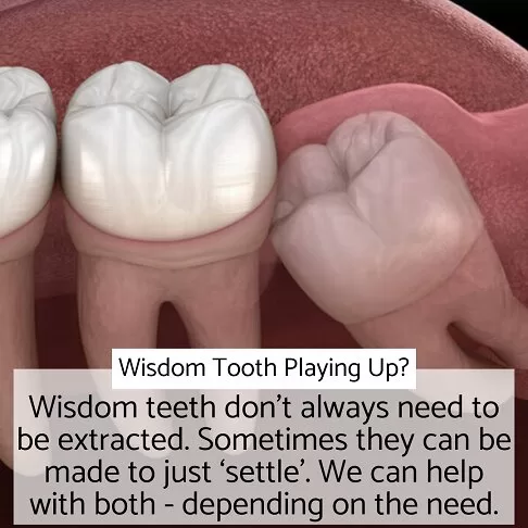 Wisdom teeth illustration, discussing options provided by Emergency Dentist Marble Arch W2 for settling or extraction