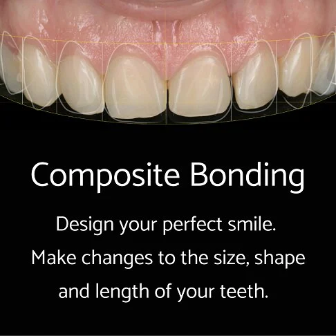 Composite Bonding London – before and after result