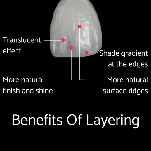 Benefits of advanced layering technique for composite bonding