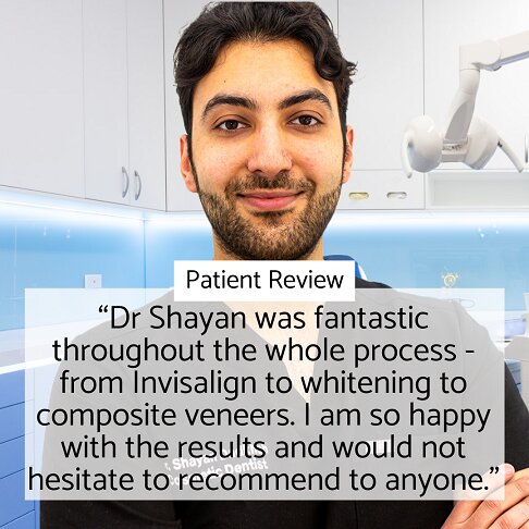 Composite Veneers patient testimonial for Dr Shayan at Whites Dental in London