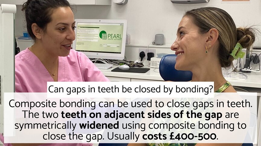 Composite bonding can close gaps between teeth in London