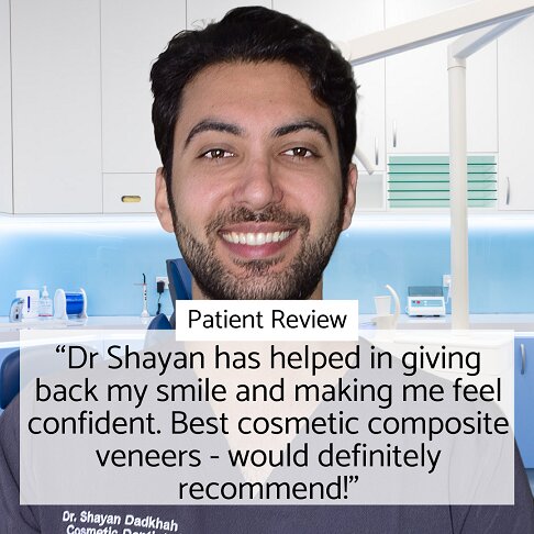 Composite veneers review for Dr Shayan at Whites Dental in London