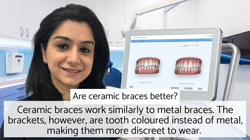 Dentist explaining ceramic braces are more discreet than metal braces