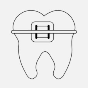 Fixed braces treatment