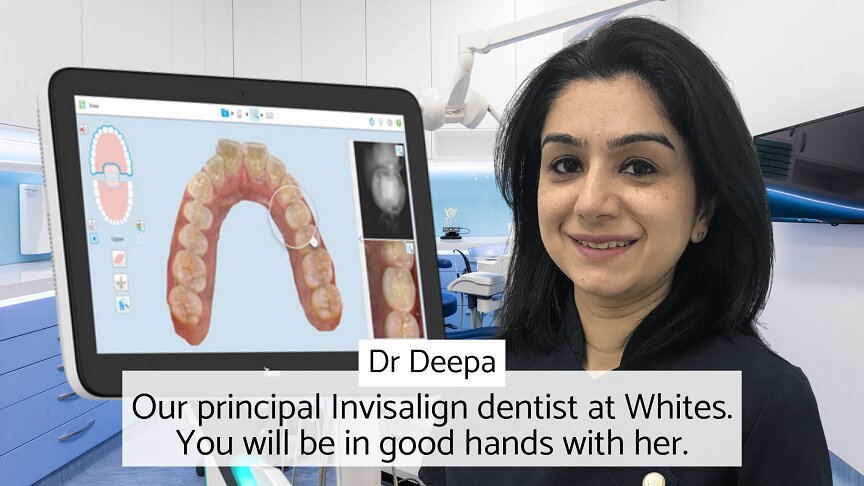 Patient reviews and testimonials for our Principal Invisalign dentist at Whites Dental - Dr Deepa