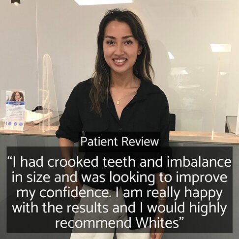 Patient testimonial for our composite bonding dentist in London Marble Arch W2