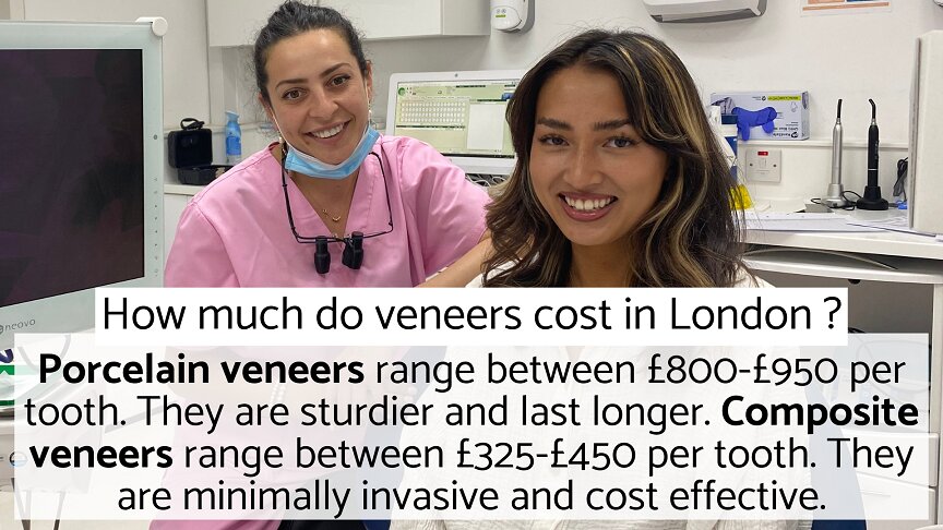 Veneers Cost London - How Much Do Veneers Cost In London