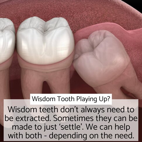 Wisdom tooth requiring extraction